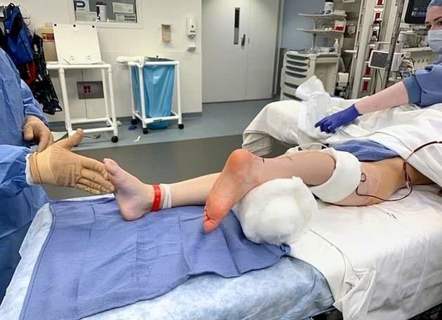 美国男孩患癌截肢,医生把截下的左脚脚尖朝后接在腿上给他当膝盖