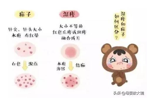 新生宝宝常见问题和疾病的预防及护理!妈妈这样做,宝宝少生病