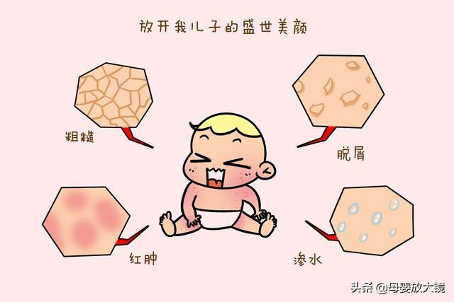 新生宝宝常见问题和疾病的预防及护理!妈妈这样做,宝宝少生病