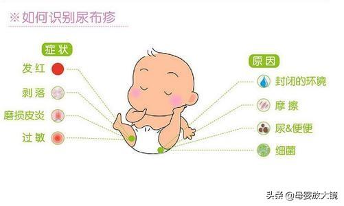 新生宝宝常见问题和疾病的预防及护理!妈妈这样做,宝宝少生病