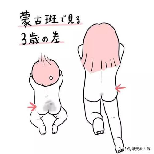 新生宝宝常见问题和疾病的预防及护理!妈妈这样做,宝宝少生病