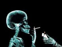 生活保健有妙招(3)保心护脑防猝死!