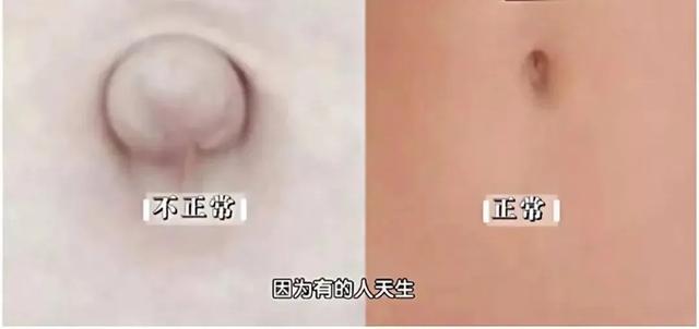 肝:最沉默的器官,如何抓住病变的蛛丝马迹?简单自查