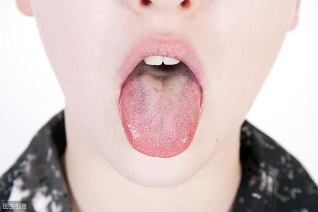 三甲医生:胃好不好,看舌头就知道!舌出现4个情况,胃出问题了