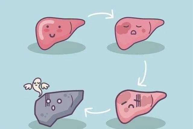 肝硬化患者注意:不想病情加重,那么请离这4种食物远一些!