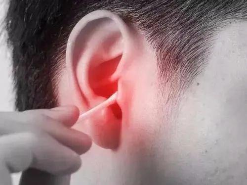 总觉得耳朵痒却又掏不出东西?可能暗示这5个问题,别忽视了