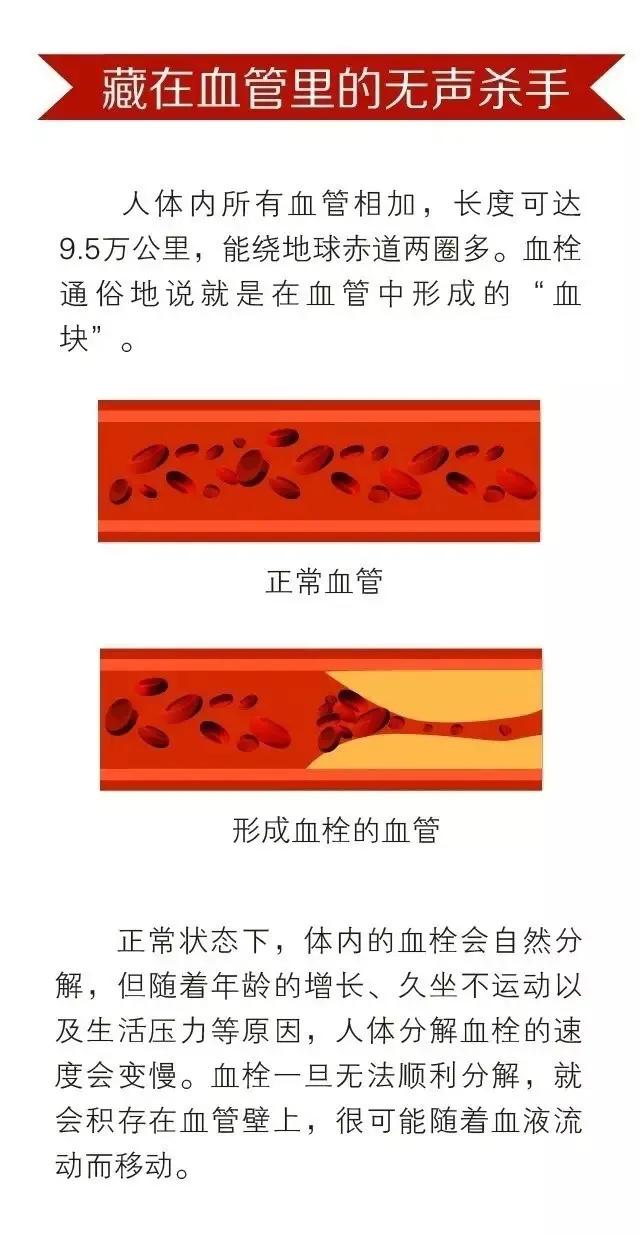 茶水是最好的“抗血栓药”?远离血栓,五点秘诀要记本上