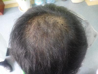 身上出现这5种现象,说明你是真的开始变老了,别不服气!