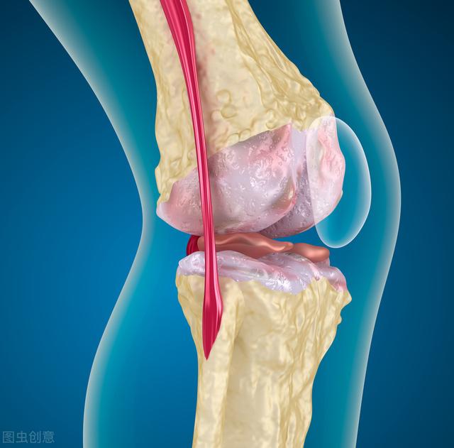 这3类人群是骨质疏松的高发人群!专家教你这样治疗