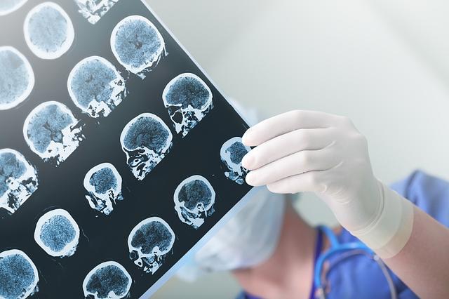医生直言:要想血管不“崩溃”,坚持做到以下4点,让血管软起来