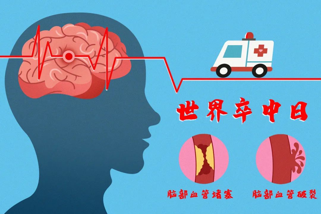 【慢病防控】每四个人中就会发生!这种疾病重在预防!