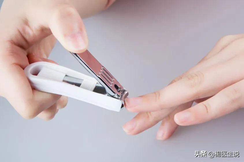 指甲上的“月牙”越多越健康?真的是这样吗?一次性说清楚!