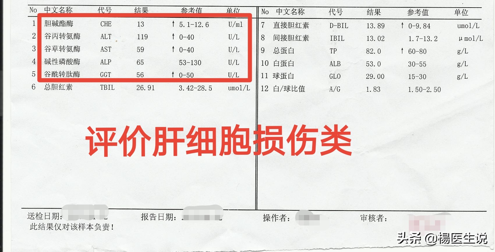 肝功能化验报告单看不懂?医生这样分析,一目了然