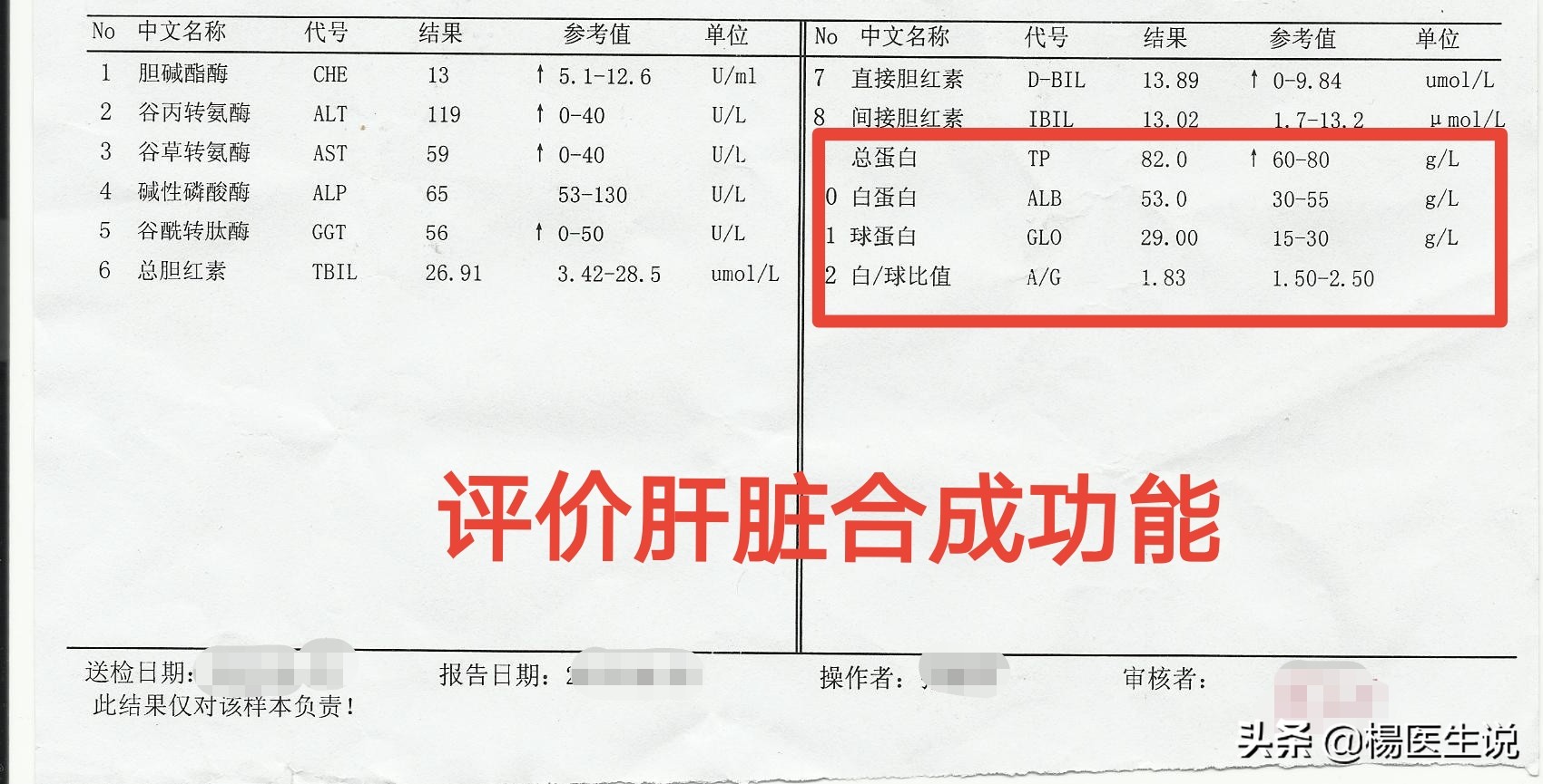 肝功能化验报告单看不懂?医生这样分析,一目了然