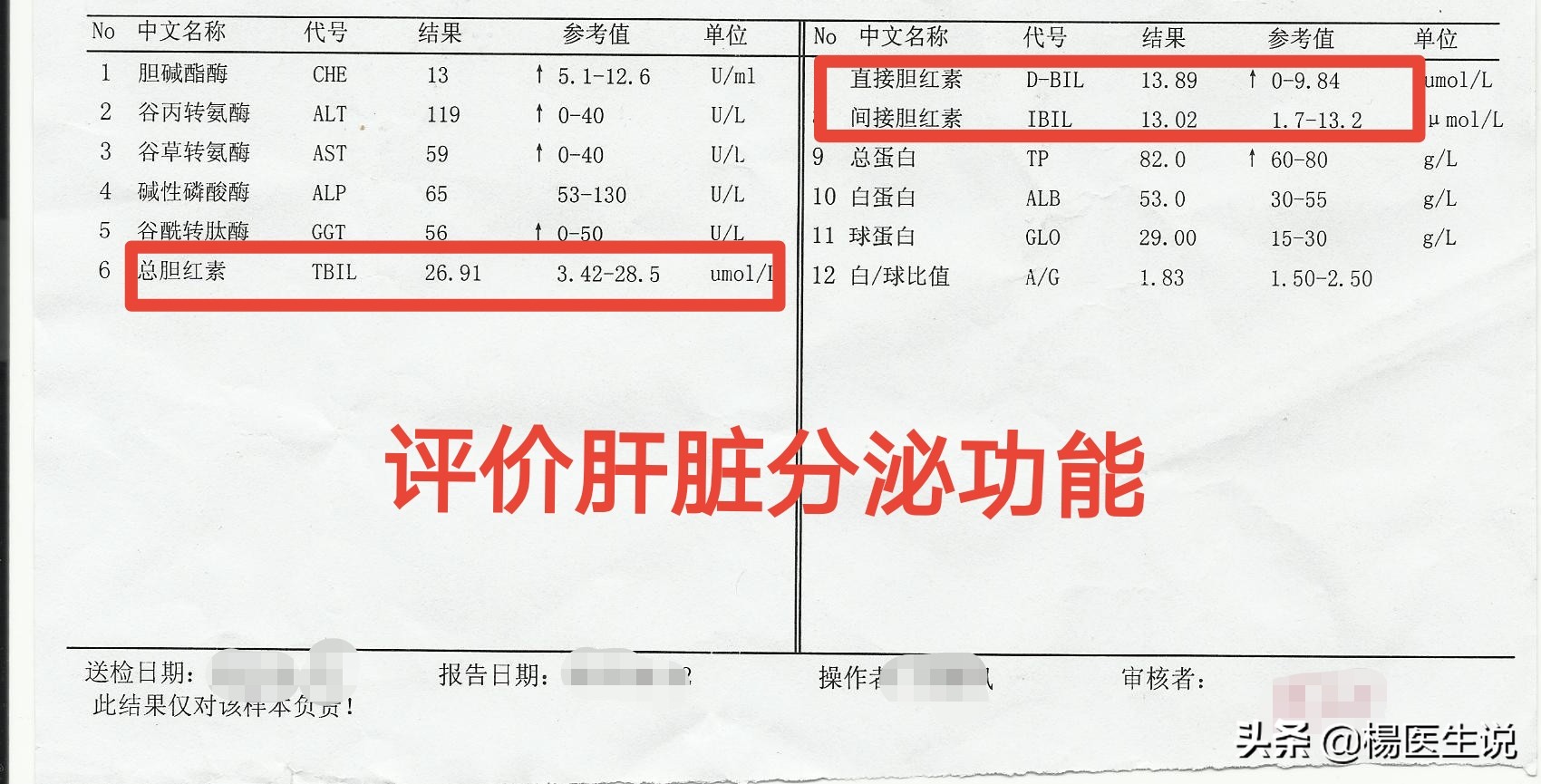 肝功能化验报告单看不懂?医生这样分析,一目了然