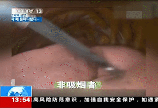 吸烟的肺部有多黑?戒烟后,肺能重新变白吗?