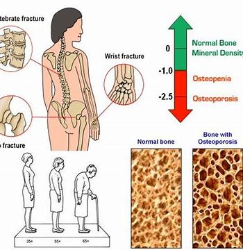 50多岁女性感觉疼痛、焦虑,都是因为更年期吗?医生为您讲清楚