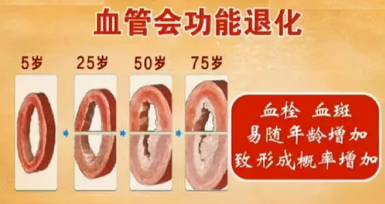 保持血管年轻,别做这5件事,多学这5招