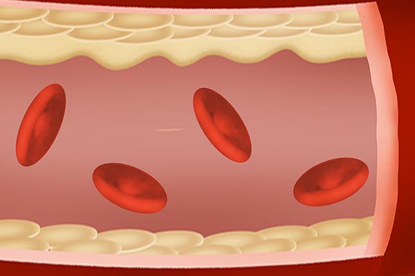 体内有血栓，身上会“喊疼”，哪些部位的疼痛，暗示血管差？