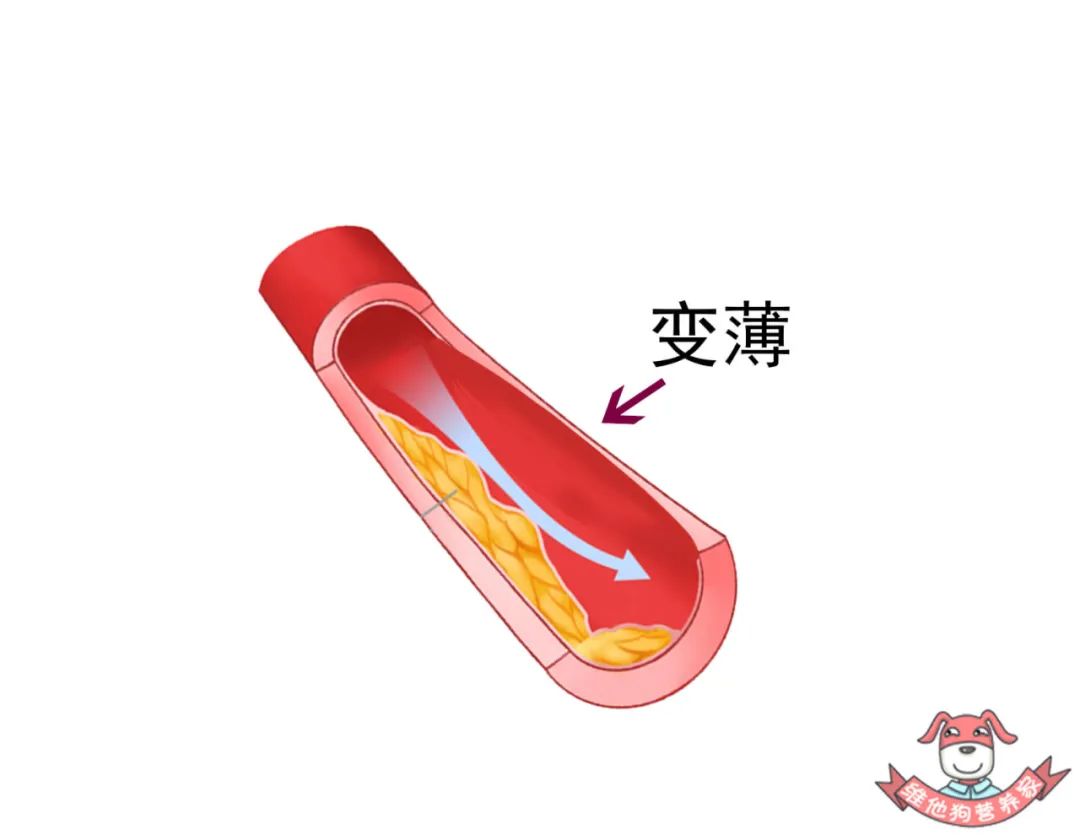 胆固醇越低越好?它的危害可比你想象中要严重