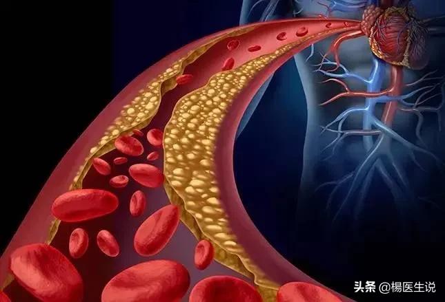 美专家:吃鸡蛋,会增加心血管疾病,中国专家:这锅我们不背!