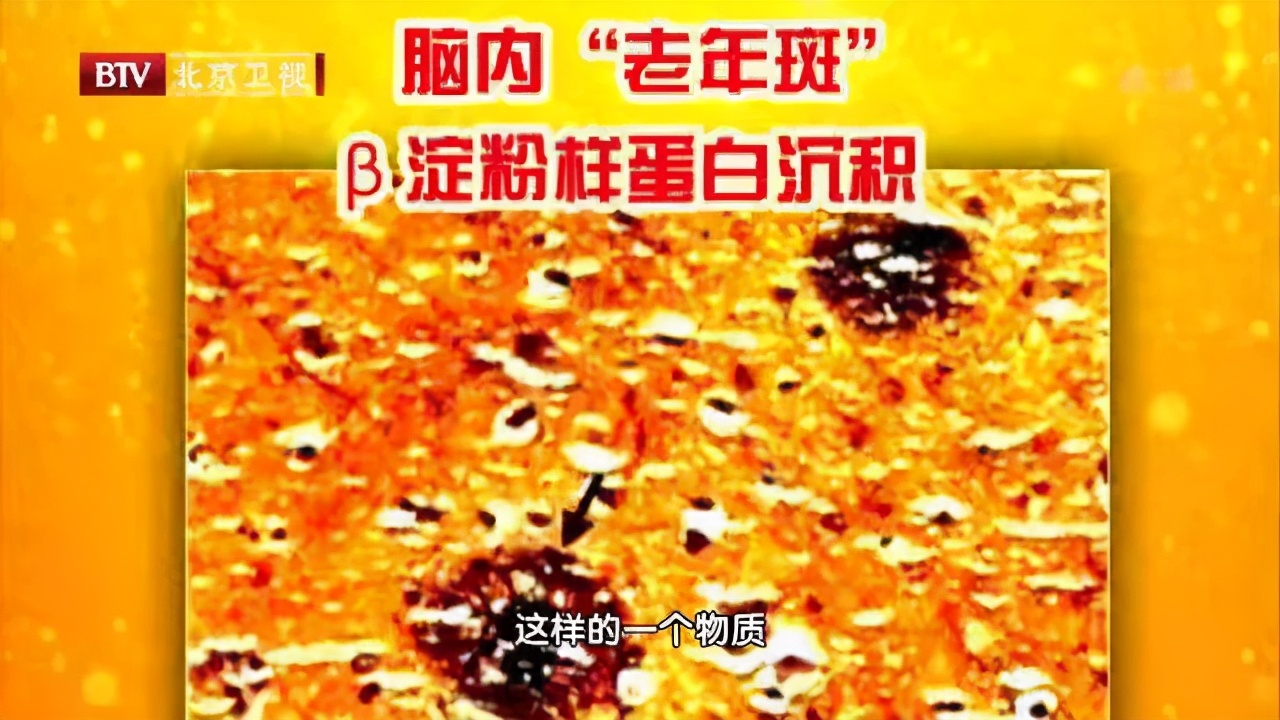 这些事会让大脑堆满“垃圾”,引发老年痴呆!三招“清扫”法,还你“干净”大脑