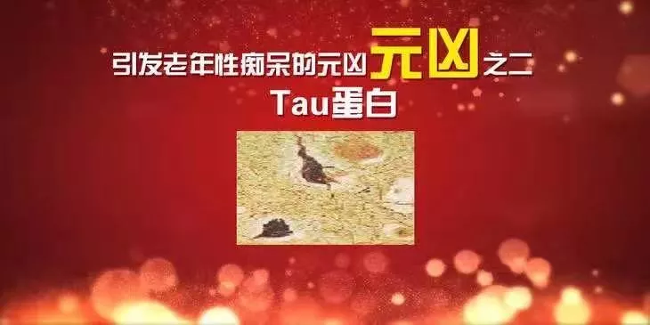 这些事会让大脑堆满“垃圾”,引发老年痴呆!三招“清扫”法,还你“干净”大脑