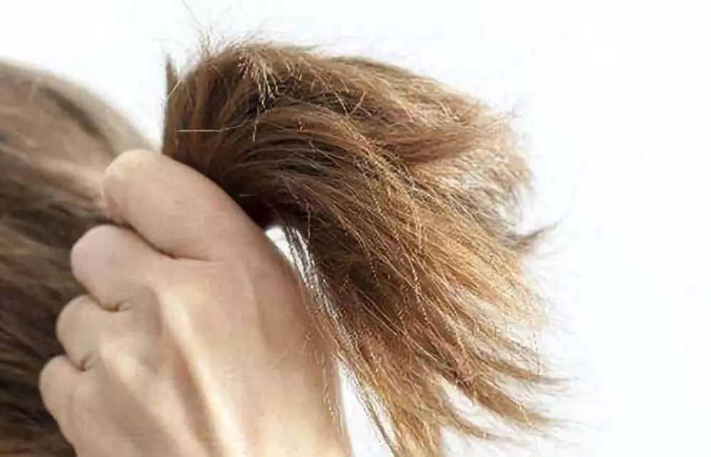 中医:头发病变与内脏状态有何关系?