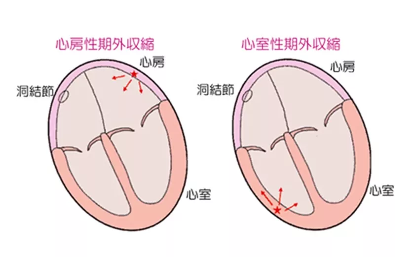 经常心慌,心律不齐,晚上容易害怕,该怎么调养呢?